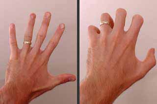 finger stretching exercises