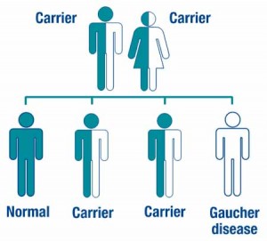 gaucher disease