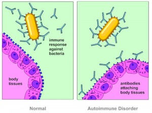 Autoimmune disease